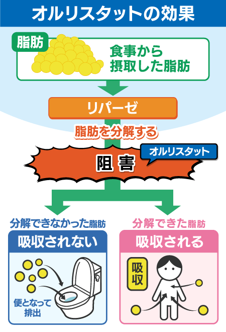 リパーゼ阻害薬の作用機序